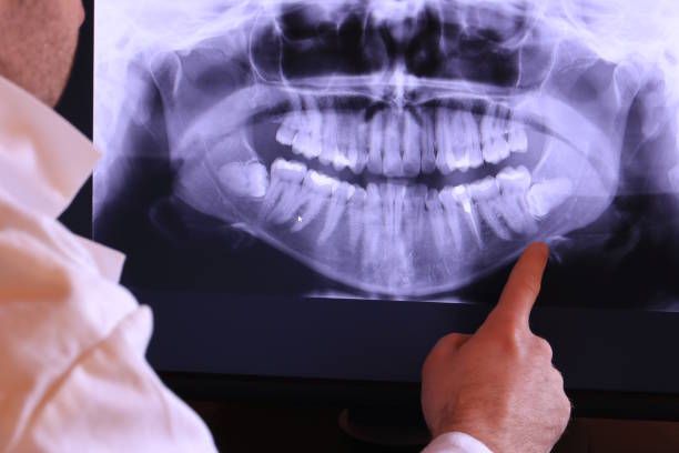 Best Tooth Infection Emergency Dentist  in Hampton Beach, NH